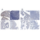 Anti-SPATA18 Antibody