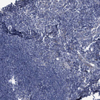 Anti-SPATA18 Antibody