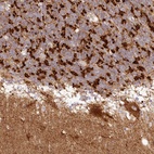 Anti-TBC1D14 Antibody