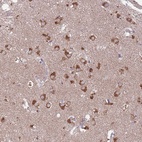 Anti-STIM2 Antibody