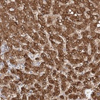 Anti-NIT2 Antibody