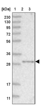 Anti-NIT2 Antibody