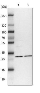 Anti-NIT2 Antibody