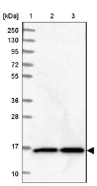 Anti-NUDCD2 Antibody