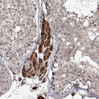 Anti-RANBP3L Antibody