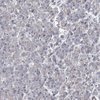 Anti-RANBP3L Antibody