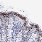 Anti-FBXW12 Antibody