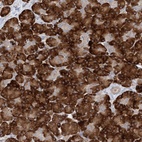 Anti-MMADHC Antibody