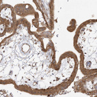 Anti-MMADHC Antibody