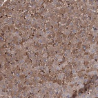 Anti-RPUSD3 Antibody