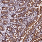 Anti-C1D Antibody