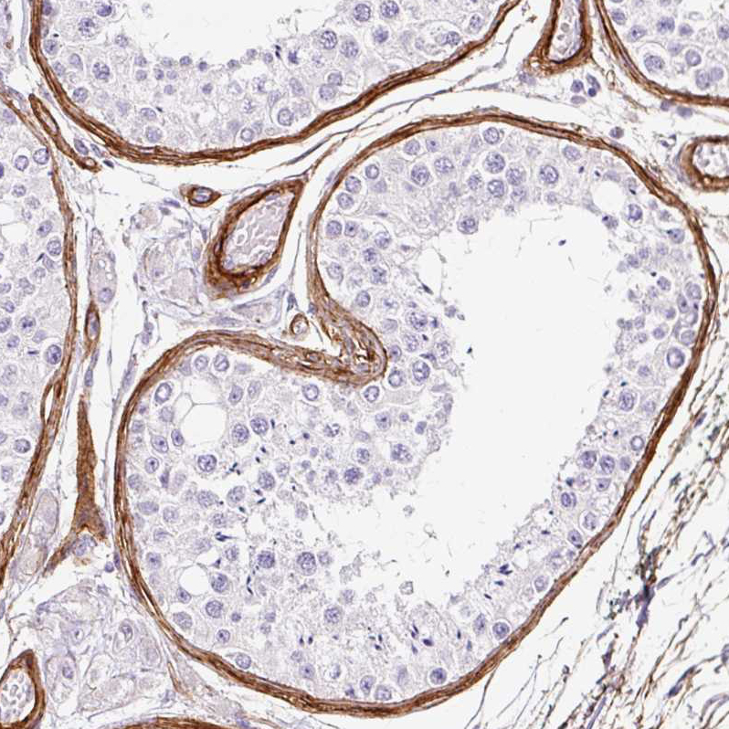 Anti-LOXL4 Antibody