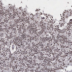 Anti-C6orf1 Antibody