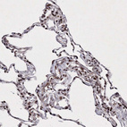 Anti-C6orf1 Antibody