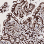 Anti-C6orf1 Antibody