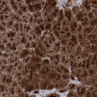 Anti-MOCS2 Antibody