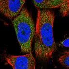 Anti-MOCS2 Antibody