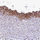 Anti-SH3TC2 Antibody