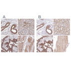 Anti-FCHO2 Antibody