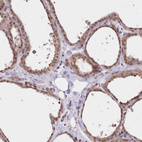 Anti-FCHO2 Antibody