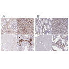 Anti-TPP1 Antibody