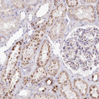 Anti-TPP1 Antibody