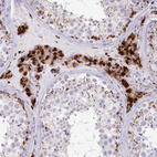 Anti-TPP1 Antibody