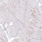 Anti-TPP1 Antibody