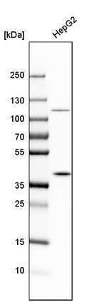 Anti-MAT2B Antibody