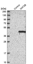 Anti-MAT2B Antibody