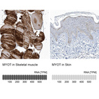 Anti-MYOT Antibody