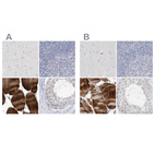 Anti-MYOT Antibody