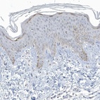 Anti-MYOT Antibody