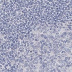 Anti-MYOT Antibody