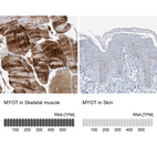 Anti-MYOT Antibody