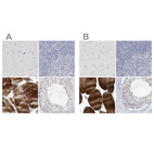 Anti-MYOT Antibody