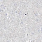 Anti-MYOT Antibody