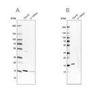 Anti-POLR2H Antibody