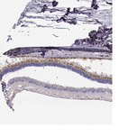 Anti-LRIT2 Antibody