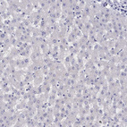 Anti-LRIT2 Antibody