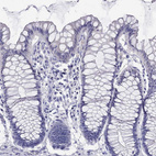 Anti-LRIT2 Antibody