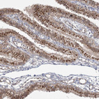 Anti-KBTBD4 Antibody