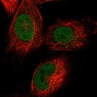 Anti-KBTBD4 Antibody