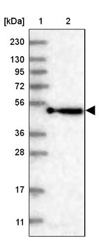 Anti-KBTBD4 Antibody