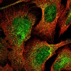 Anti-C10orf10 Antibody