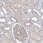 Anti-SYTL1 Antibody