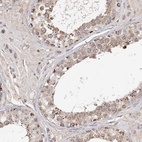 Anti-CDC123 Antibody