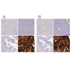 Anti-MYOZ1 Antibody