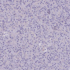 Anti-MYOZ1 Antibody