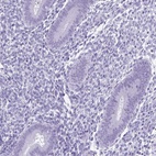 Anti-SPATA16 Antibody